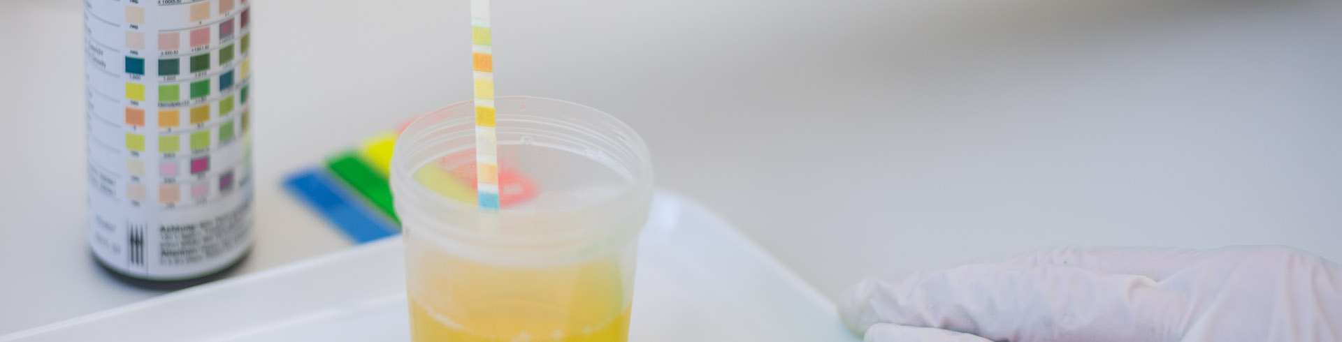 Urinprobe im Labor der Hausarztpraxis